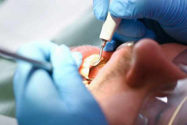 Best Weekend Emergency Dentist in Dunwoody, GA